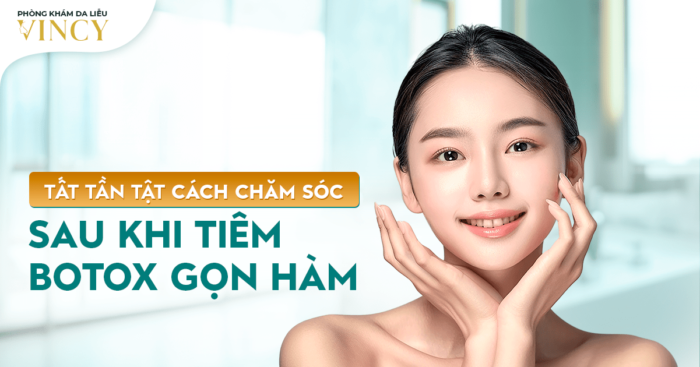 TẤT TẦN TẬT CÁCH CHĂM SÓC SAU KHI TIÊM BOTOX GỌN HÀM