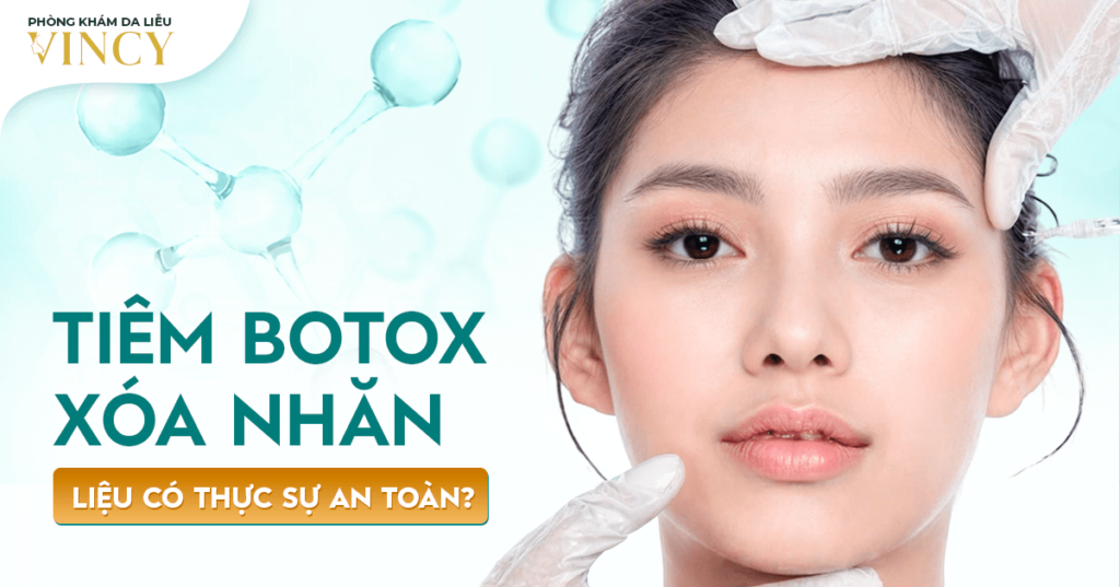 TIEM BOTOX XOA NHAN. LIEU CO THUC SU AN TOAN